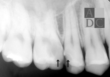 術前-thumb-450x315