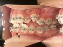 左側方sl-thumb-220x165